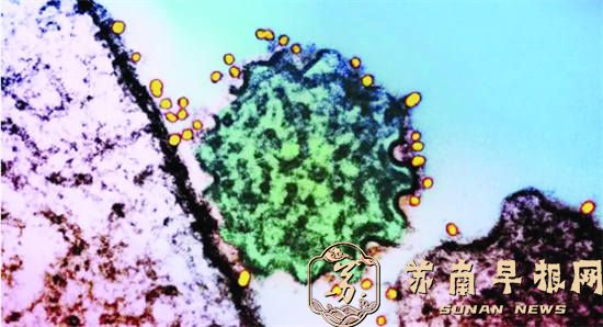 &ldquo;隐形杀手&rdquo;尼帕病毒究竟是个啥